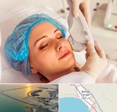اکسنت در بندر کنگان