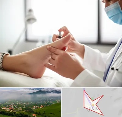 متخصص زخم دیابت در خلخال