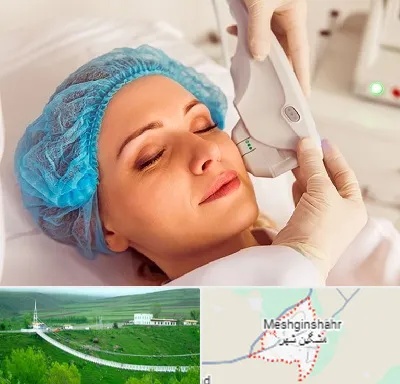 اکسنت در مشگین شهر