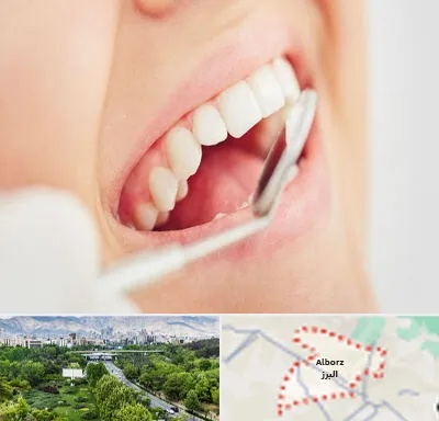 اصلاح طرح لبخند در البرز
