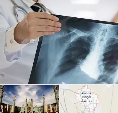فوق تخصص ریه در آران و بیدگل