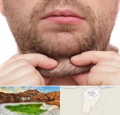 ساکشن غبغب در گرمسار