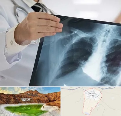 فوق تخصص ریه در گرمسار