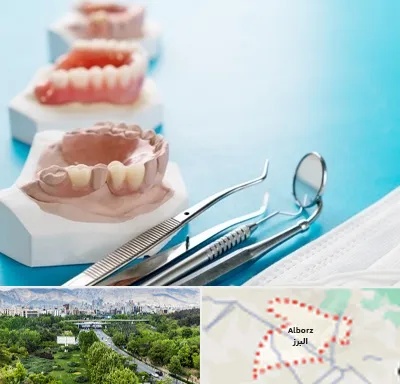 متخصص روکش دندان در البرز