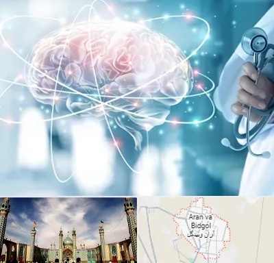 دکتر سکته مغزی در آران و بیدگل