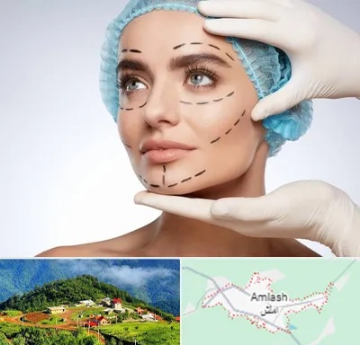 جراحی زیبایی در املش