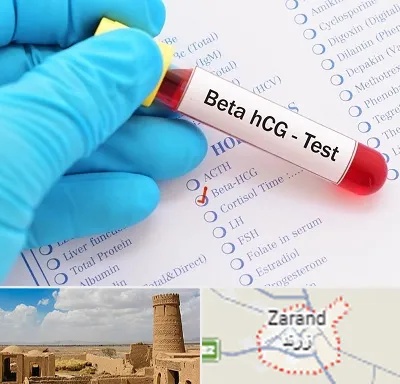 آزمایشگاه بارداری در زرند