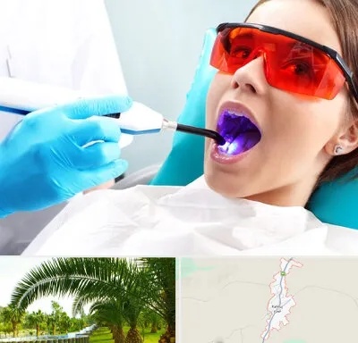 جراحی لثه با لیزر در کهنوج
