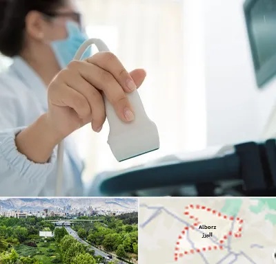 اکوی قلب در البرز