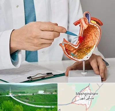 دکتر سرطان معده در مشگین شهر
