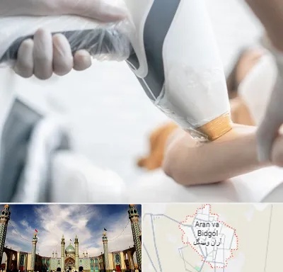 تجهیزات پزشکی زیبایی در آران و بیدگل