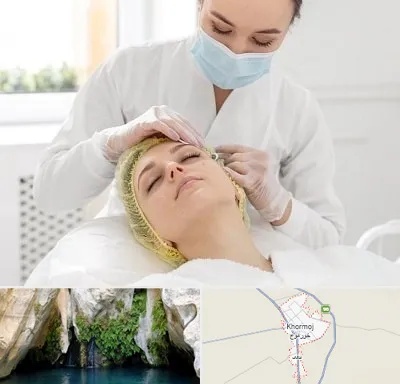 کلینیک زیبایی در خورموج