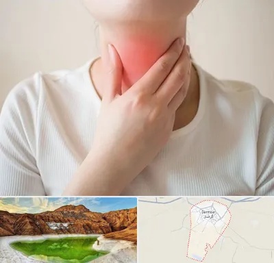 دکتر سرطان مری در گرمسار