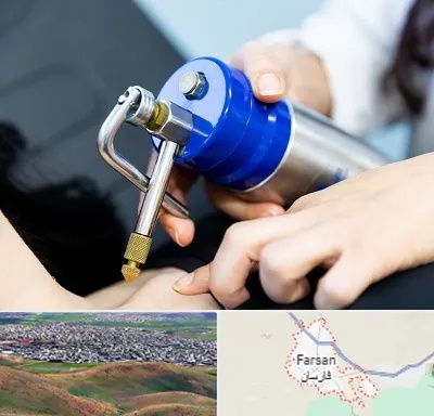کرایوتراپی در فارسان