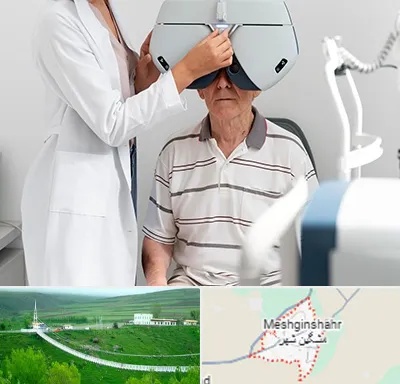 دکتر سرطان چشم در مشگین شهر