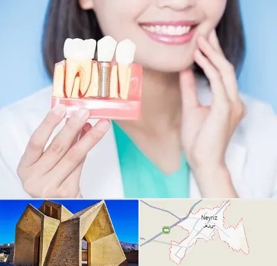 متخصص ایمپلنت در نی ریز
