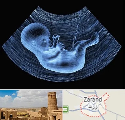 دکتر متخصص غربال گری در زرند