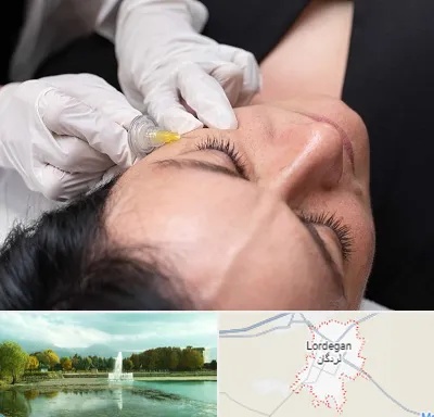 کربوکسی تراپی در لردگان
