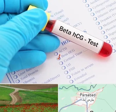 آزمایشگاه بارداری در پارس آباد