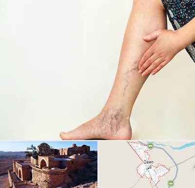 دکتر واریس در قائن