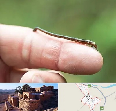 مرکز زالو درمانی در قائن