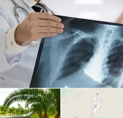 فوق تخصص ریه در کهنوج