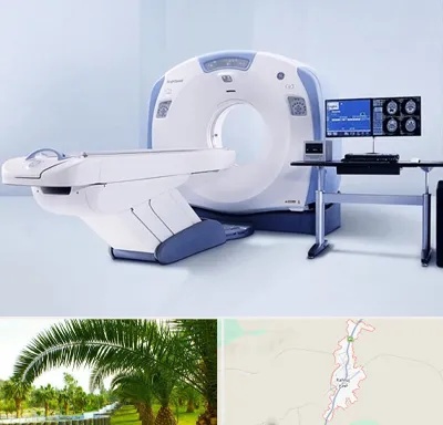 سی تی اسکن شبانه روزی در کهنوج