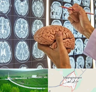 دکتر فوق تخصص جراح مغز و اعصاب در مشگین شهر
