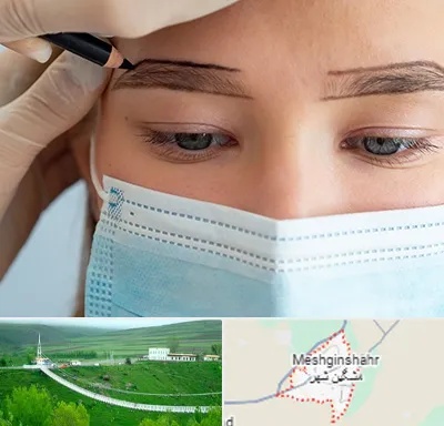 کاشت ابرو در مشگین شهر