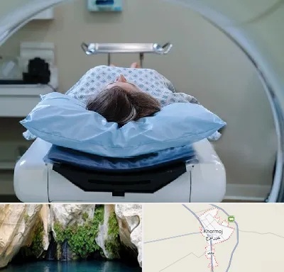 رادیولوژی فک و صورت در خورموج