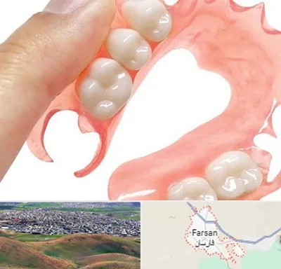 پروتز متحرک دندان در فارسان
