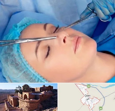 عمل بینی نیمه فانتزی در قائن