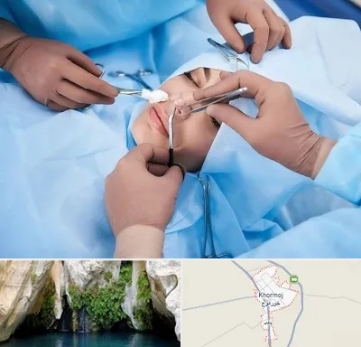 عمل بینی فانتزی در خورموج