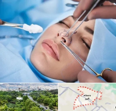 عمل ترمیمی بینی در البرز