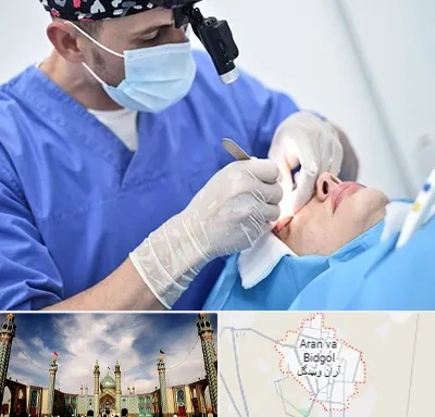 جراح سرطان چشم در آران و بیدگل