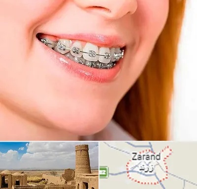 ارتودنسی ارزان در زرند