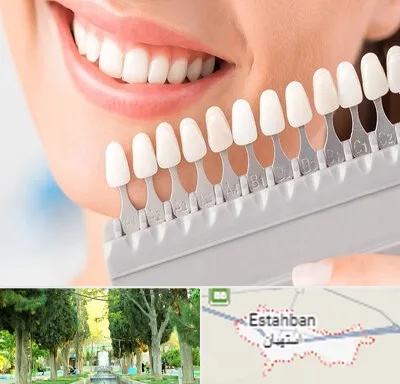 متخصص لمینت دندان در استهبان