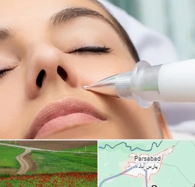 پلاسما جت بینی در پارس آباد