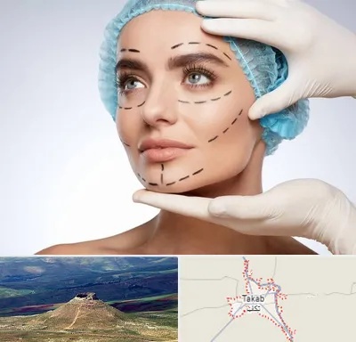 جراحی زیبایی در تکاب