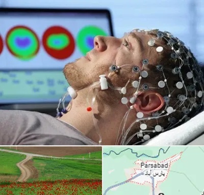 مرکز نوار مغز در پارس آباد