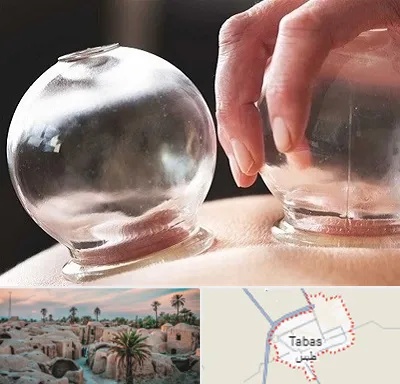 مرکز حجامت در طبس