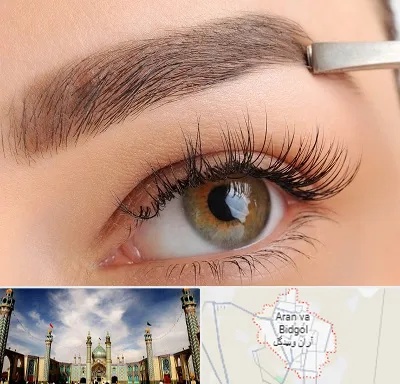 کاشت ابرو اقساطی در آران و بیدگل