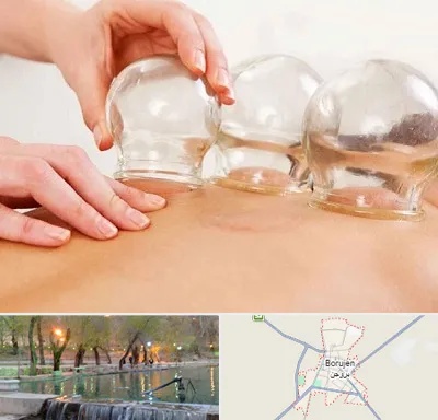 بادکش درمانی در بروجن
