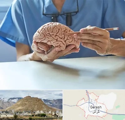 دکتر نورولوژی در گراش