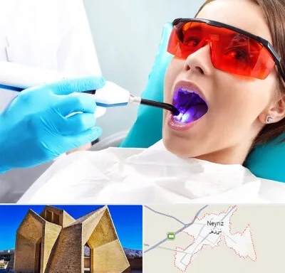 جراحی لثه با لیزر در نی ریز