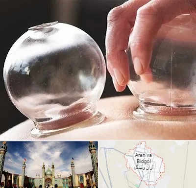 مرکز حجامت در آران و بیدگل