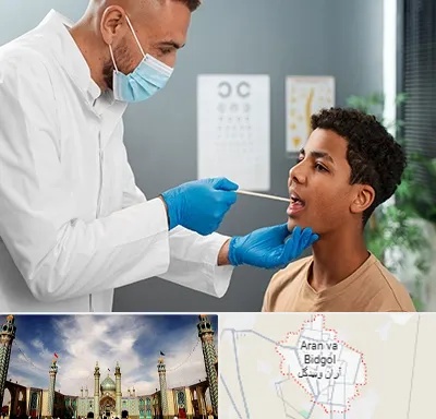 دکتر سرطان دهان در آران و بیدگل