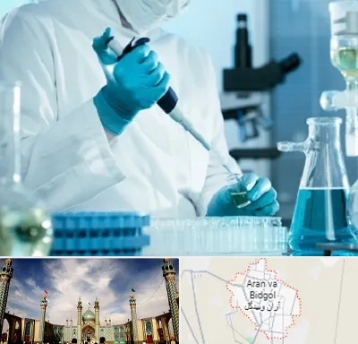 آزمایشگاه HIV در آران و بیدگل