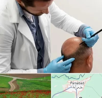 کاشت مو به روش تکثیری در پارس آباد