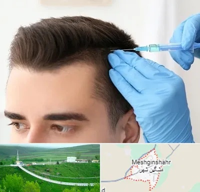 مزوتراپی مو در مشگین شهر